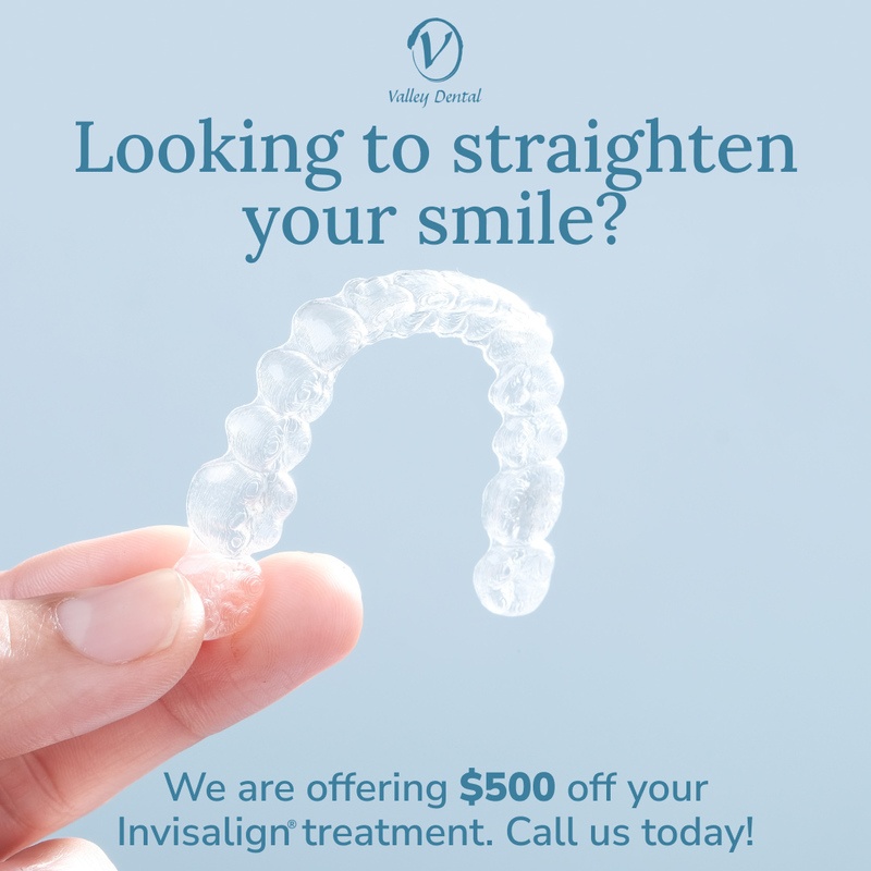 Invisalign Special